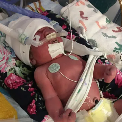 Newborn baby in the hospital hooked up to devices
